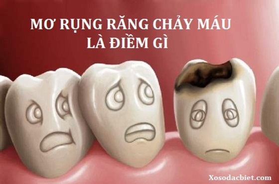 Nằm mơ thấy rụng răng là điềm gì?