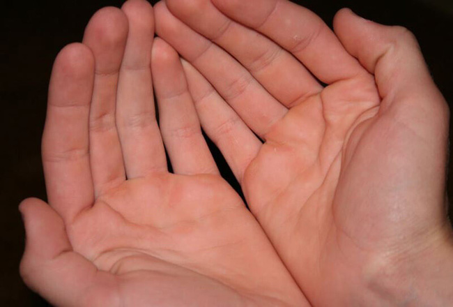 Ngứa lòng bàn tay có dấu hiệu và điềm báo gì? Tìm hiểu ngay.
